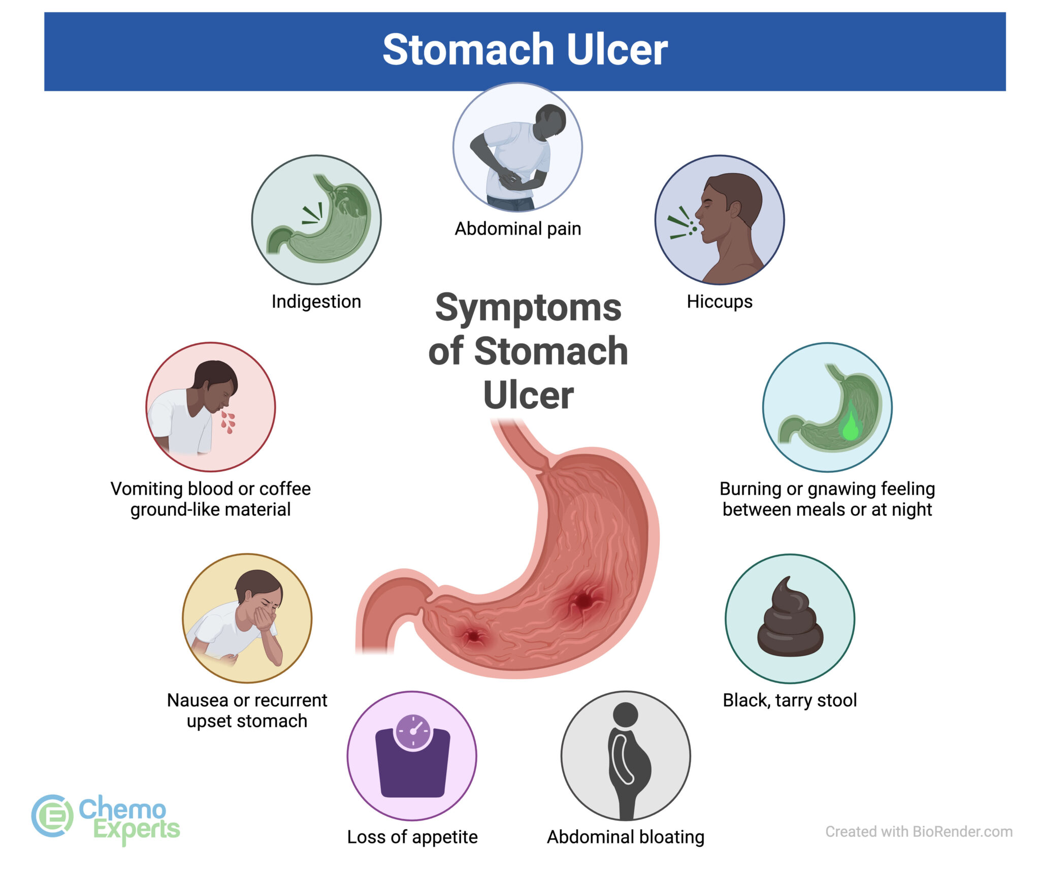 Understanding Stomach Ulcers Causes, Symptoms, And Effective